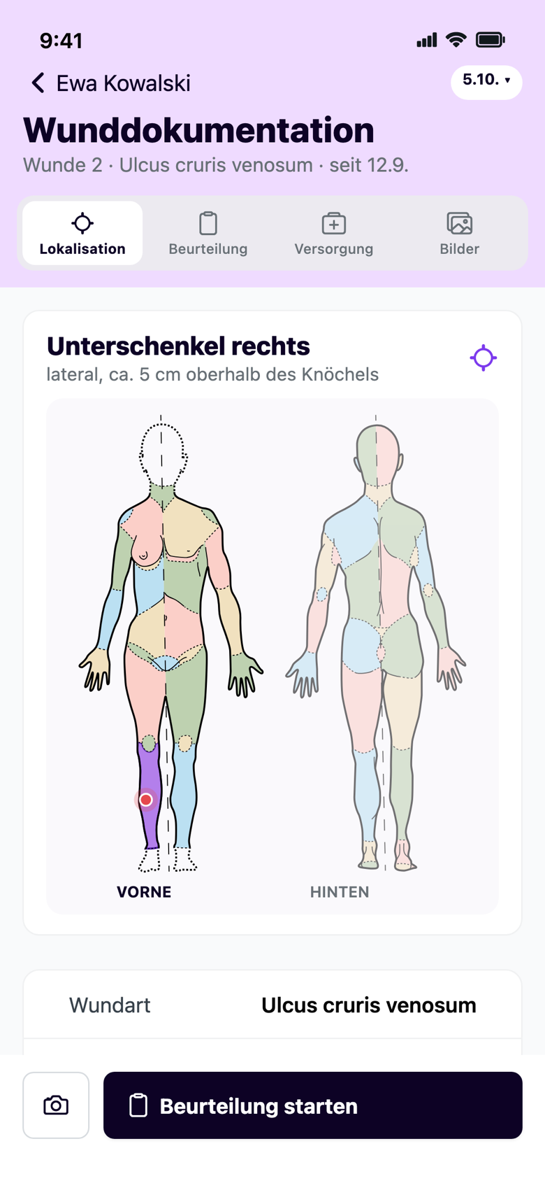Wunddokumentation mit Körperschema in der App